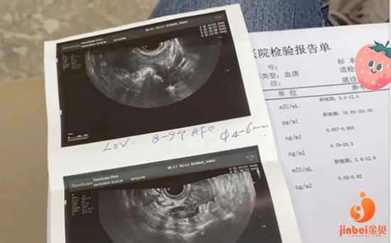 广州圆梦传承助孕中心|37岁试管的亲身经历，给你们个参考（二）